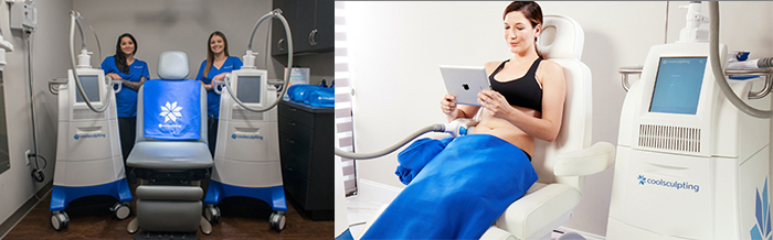 coolsculpt staff with equipment and patient