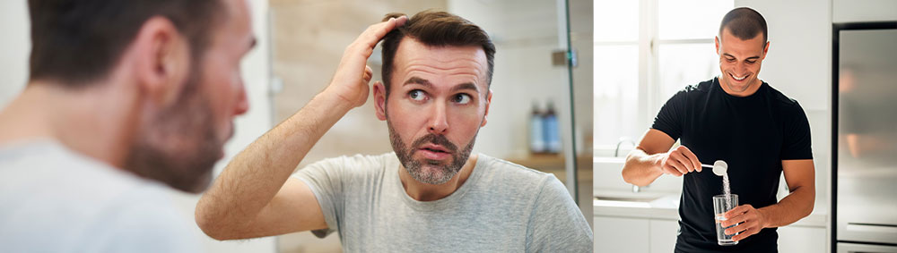 Does Creatine Cause Hair Loss