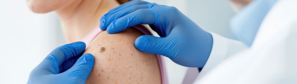 dermatologist doing skin cancer examination