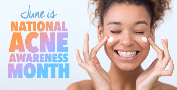 June is acne awarness month