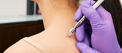 Medical and surgical dermatology in CT