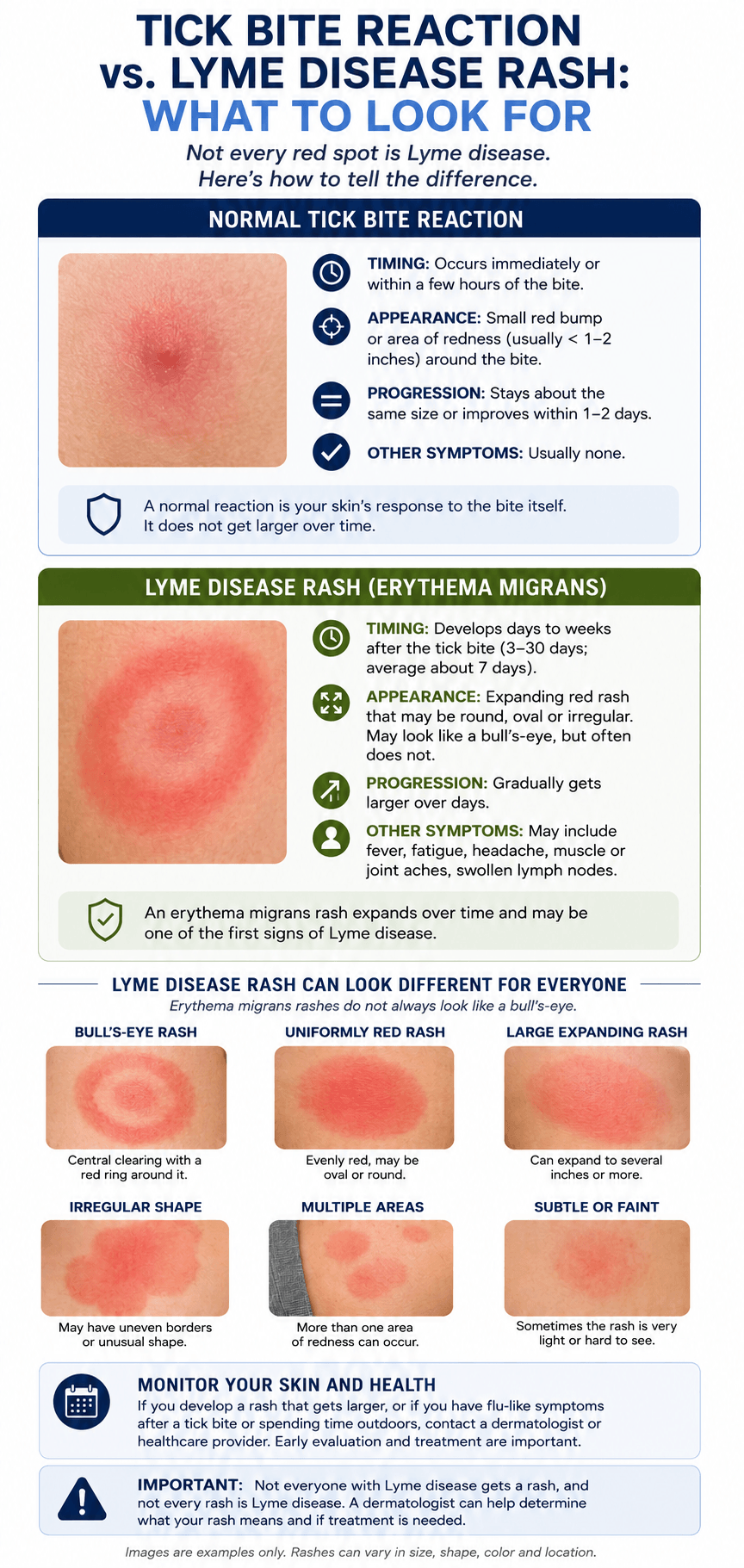 Tick bite reaction info graphic