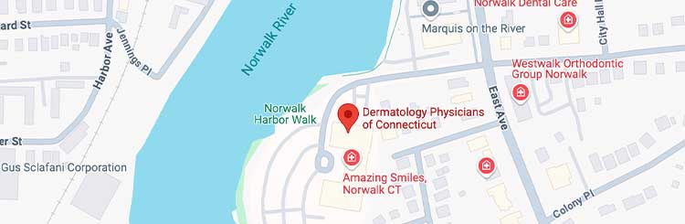 dermatologist-Norwalk-CT-map-of-location