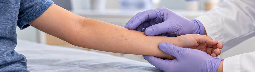 Dermatologist examining molluscum bumps on a child’s arm