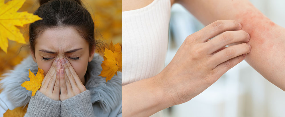 season allergies affecting skin - woman scratching skin and sneezing.jpg