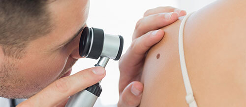 Doctor doing skin cancer screening