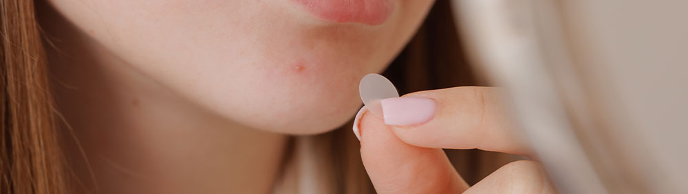 Teen using an acne patch on a chin blemish